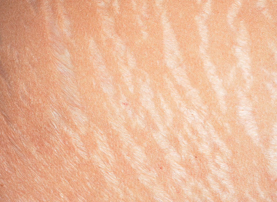 흉터 시그니처 ORACLE Signature