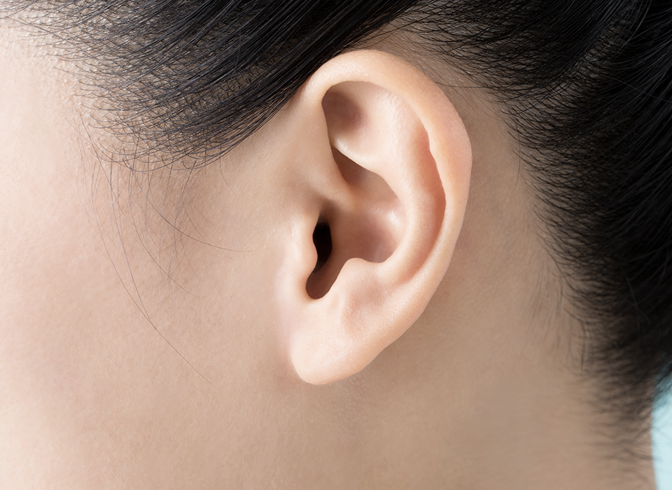 포인트 리프팅 ORACLE Lift