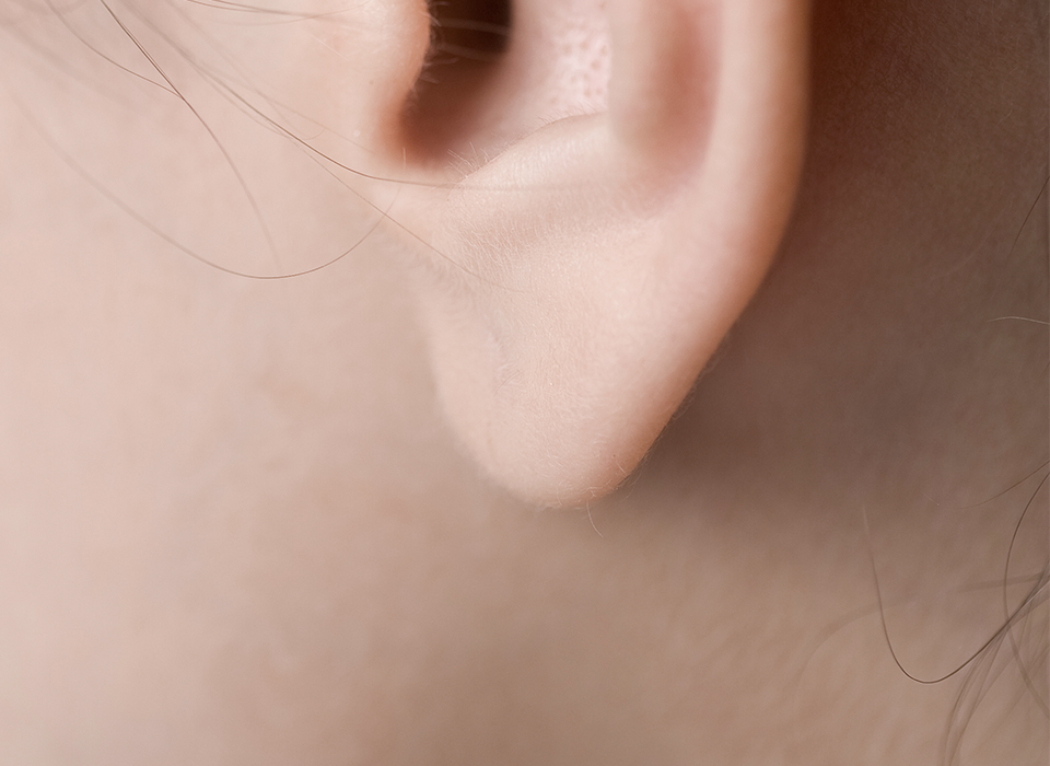 포인트 리프팅 ORACLE Lift